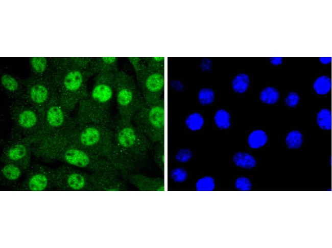 14-3-3 epsilon Antibody in Immunocytochemistry (ICC/IF)