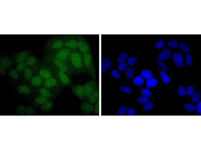 PAX5 Antibody in Immunocytochemistry (ICC/IF)