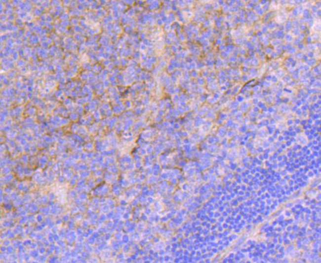 ITGA5 Antibody in Immunohistochemistry (Paraffin) (IHC (P))