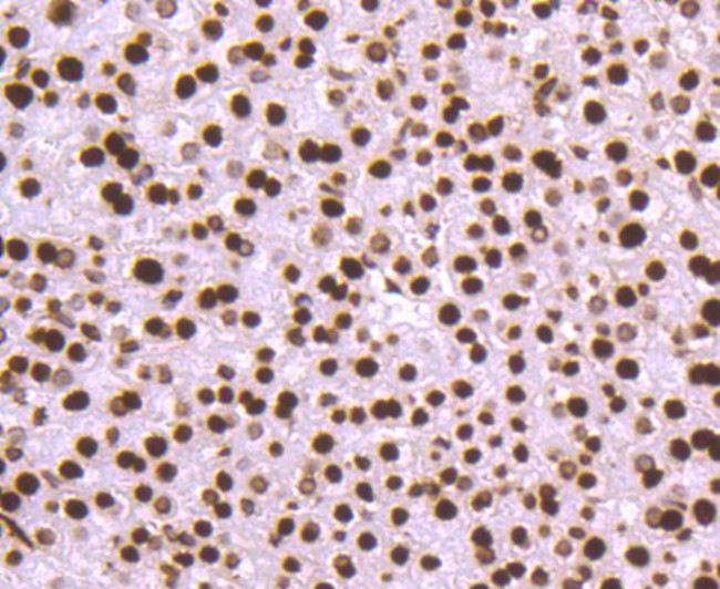 Histone H3 Antibody in Immunohistochemistry (Paraffin) (IHC (P))