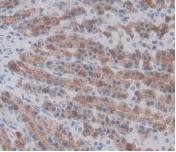 Prothrombin Antibody in Immunohistochemistry (Paraffin) (IHC (P))