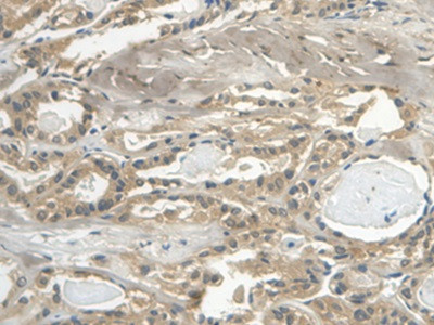 Cystatin C Antibody in Immunohistochemistry (Paraffin) (IHC (P))