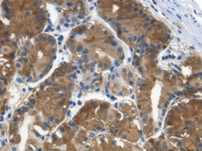 Cystatin C Antibody in Immunohistochemistry (Paraffin) (IHC (P))