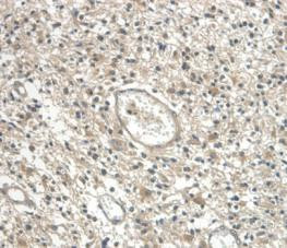 Cystatin C Antibody in Immunohistochemistry (Paraffin) (IHC (P))