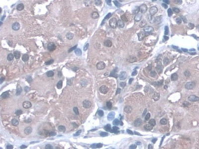 PGA5 Antibody in Immunohistochemistry (Paraffin) (IHC (P))