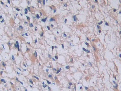 Tryptase Antibody in Immunohistochemistry (Paraffin) (IHC (P))