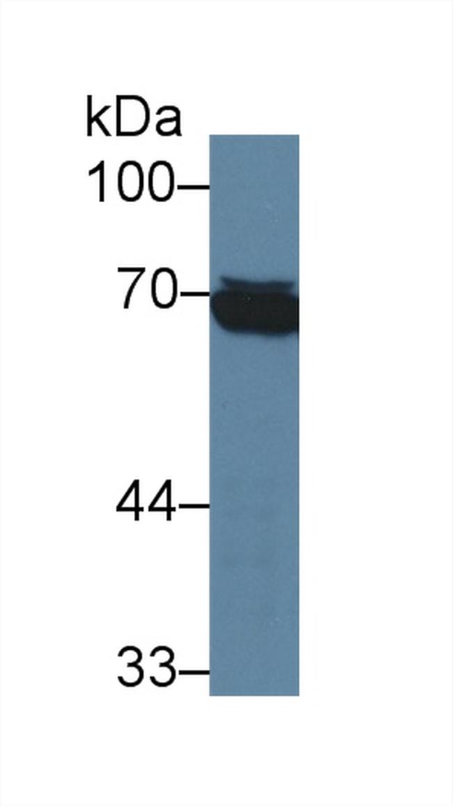 Tryptase Antibody in Western Blot (WB)