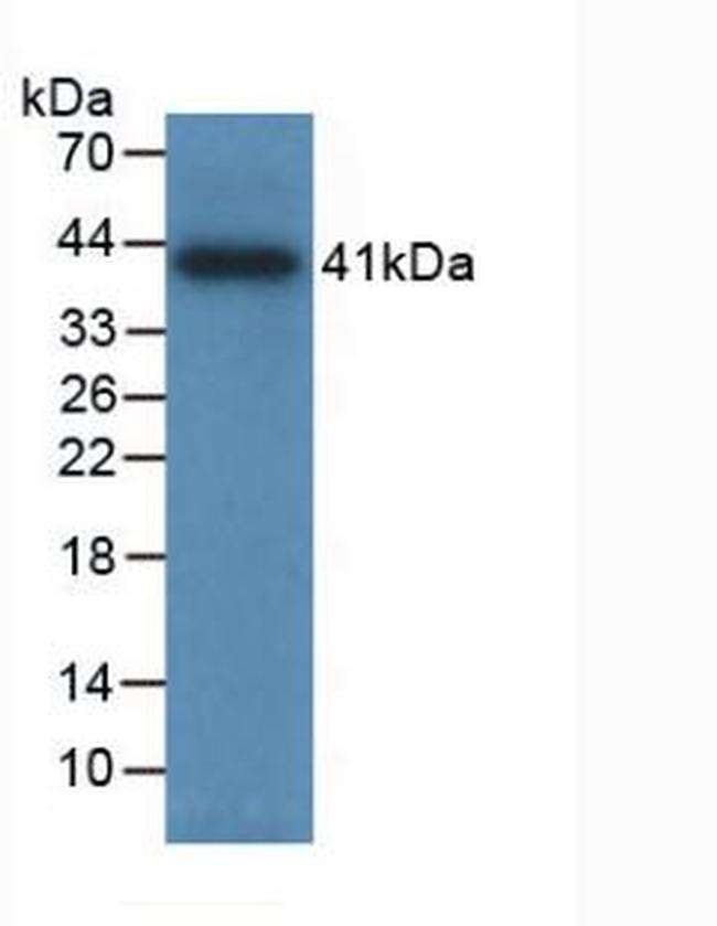 Tryptase Antibody in Western Blot (WB)