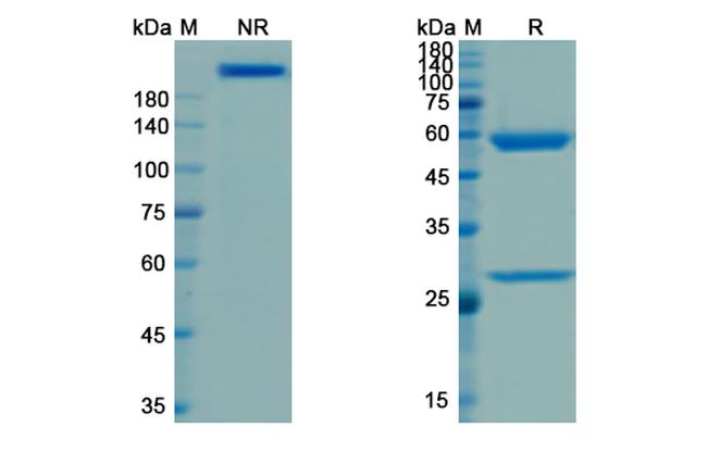 Visilizumab Humanized Antibody in SDS-PAGE (SDS-PAGE)