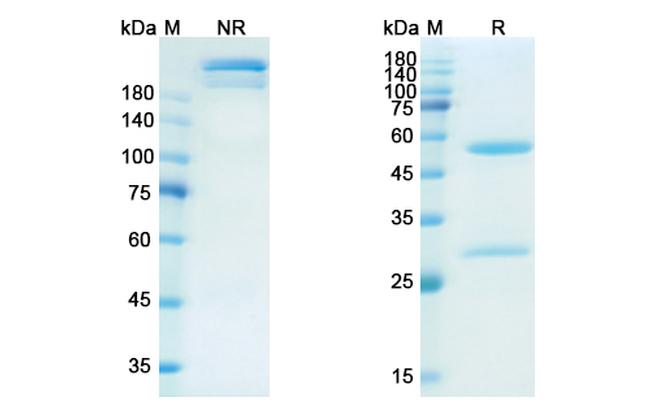 Namilumab Antibody in SDS-PAGE (SDS-PAGE)