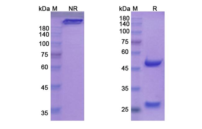 Vatelizumab Humanized Antibody in SDS-PAGE (SDS-PAGE)