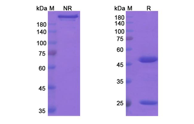 Ocaratuzumab Humanized Antibody in SDS-PAGE (SDS-PAGE)