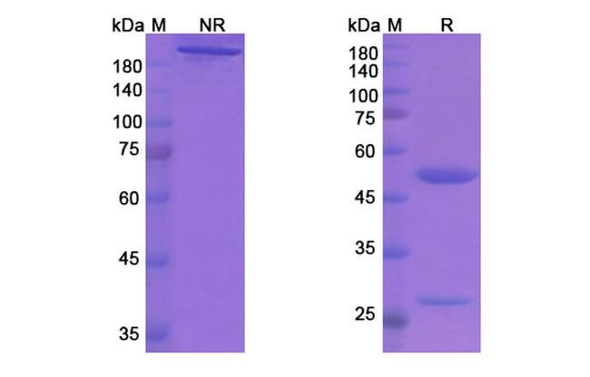 Aducanumab Antibody in SDS-PAGE (SDS-PAGE)