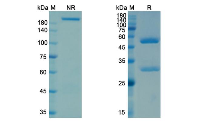 Ifabotuzumab Humanized Antibody in SDS-PAGE (SDS-PAGE)