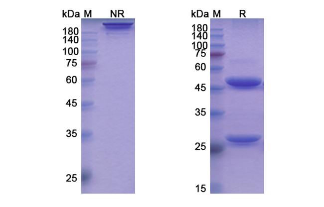 Ianalumab Antibody in SDS-PAGE (SDS-PAGE)