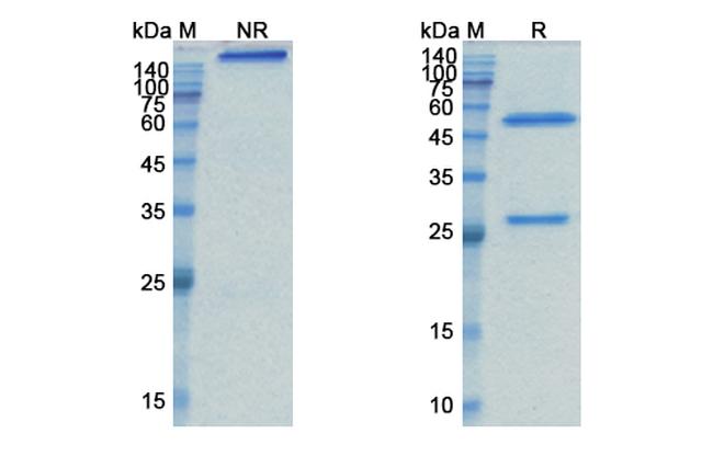 Tabituximab Chimeric Antibody in SDS-PAGE (SDS-PAGE)