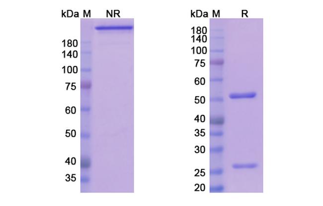 Teplizumab Humanized Antibody in SDS-PAGE (SDS-PAGE)