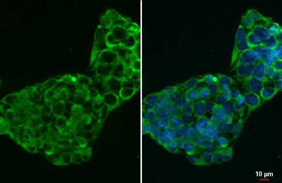 CTGF Antibody in Immunocytochemistry (ICC/IF)