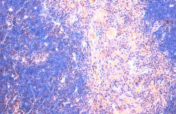 CTGF Antibody in Immunohistochemistry (Paraffin) (IHC (P))