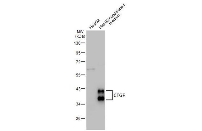 CTGF Antibody in Western Blot (WB)