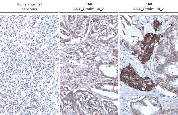 Thrombospondin 2 Antibody in Immunohistochemistry (Paraffin) (IHC (P))