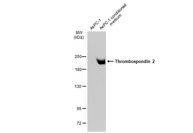 Thrombospondin 2 Antibody in Western Blot (WB)