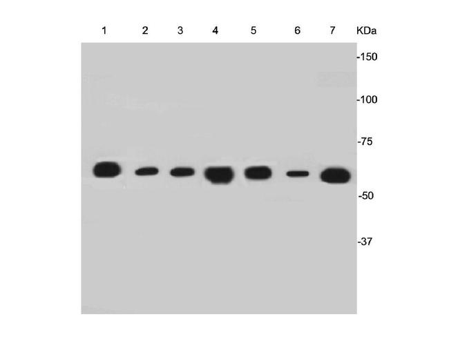 Cytokeratin 7 Monoclonal Antibody (3-G3-D8) (MA5-42388)