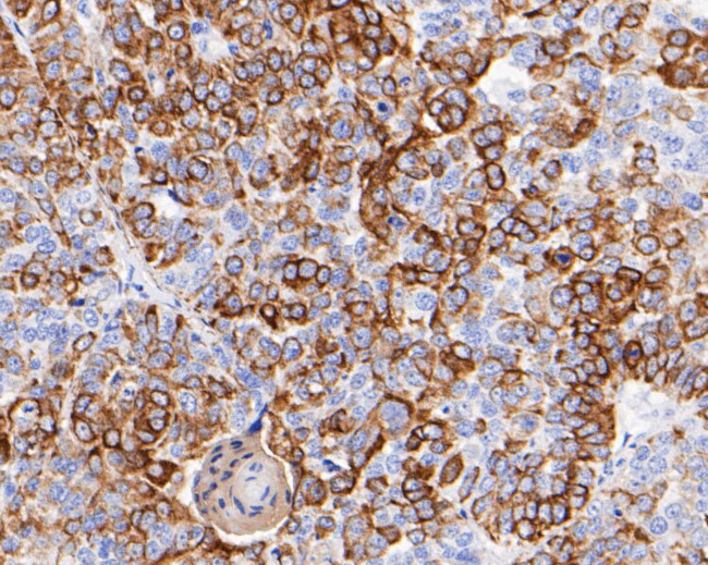 Cytokeratin 17 Antibody in Immunohistochemistry (Paraffin) (IHC (P))