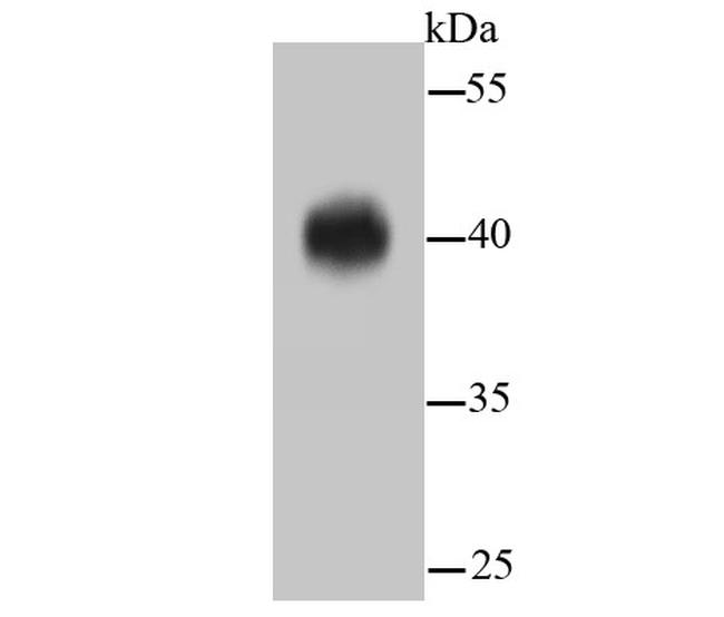 ERK1/ERK2 Antibody in Western Blot (WB)