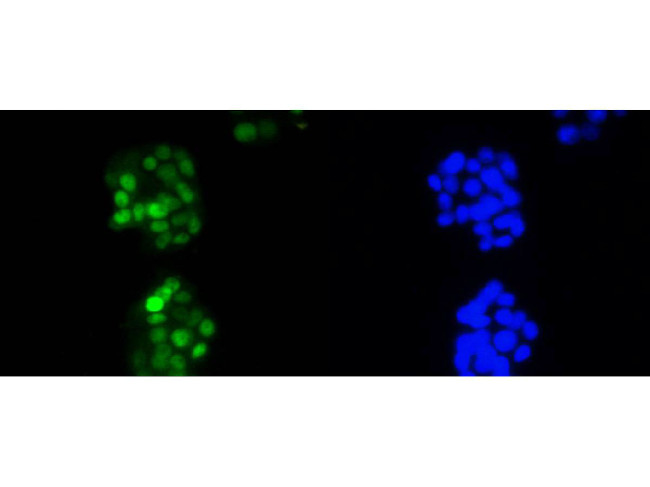 Cyclin D1 Antibody in Immunocytochemistry (ICC/IF)