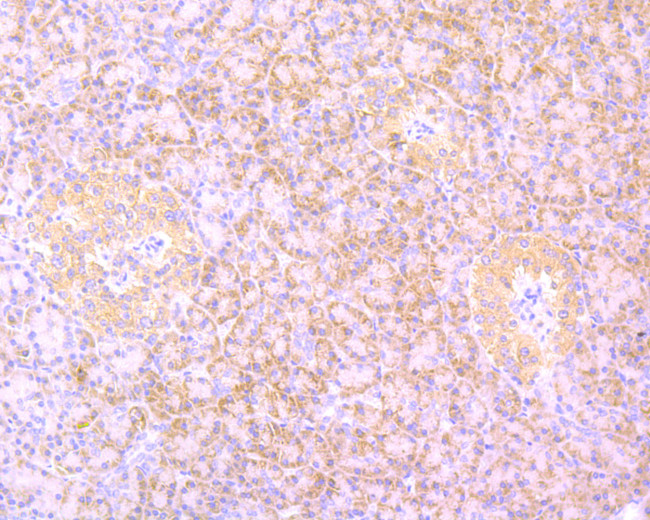 B-Raf Antibody in Immunohistochemistry (Paraffin) (IHC (P))