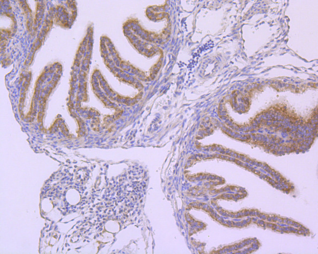 B-Raf Antibody in Immunohistochemistry (Paraffin) (IHC (P))