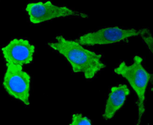 S100B Antibody in Immunocytochemistry (ICC/IF)