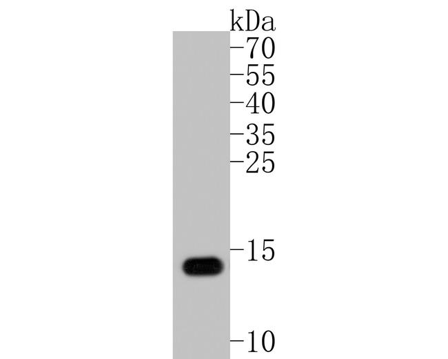 S100B Antibody in Western Blot (WB)