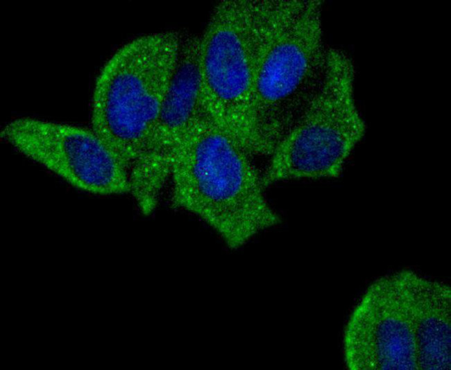 PYK2 Antibody in Immunocytochemistry (ICC/IF)