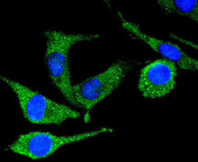 PYK2 Antibody in Immunocytochemistry (ICC/IF)