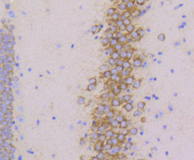 PYK2 Antibody in Immunohistochemistry (Paraffin) (IHC (P))