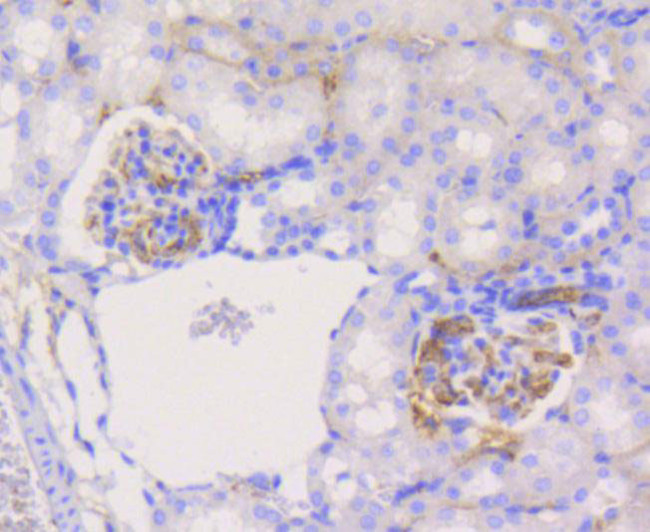 PYK2 Antibody in Immunohistochemistry (Paraffin) (IHC (P))