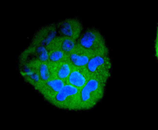 STAT5 beta Antibody in Immunocytochemistry (ICC/IF)