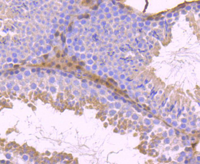 STAT5 beta Antibody in Immunohistochemistry (Paraffin) (IHC (P))