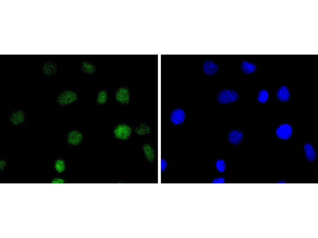 IRF2 Antibody in Immunocytochemistry (ICC/IF)