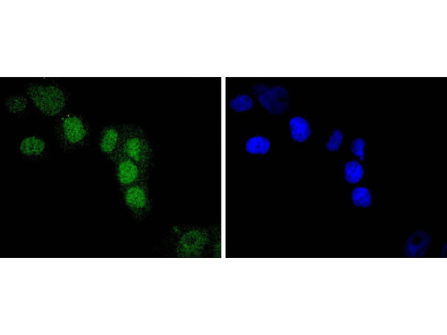 IRF2 Antibody in Immunocytochemistry (ICC/IF)