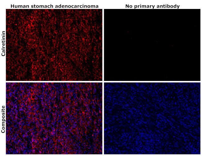 Calretinin Antibody in Immunohistochemistry (Paraffin) (IHC (P))