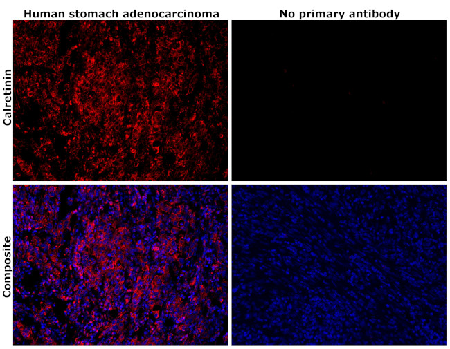 Calretinin Antibody in Immunohistochemistry (Paraffin) (IHC (P))