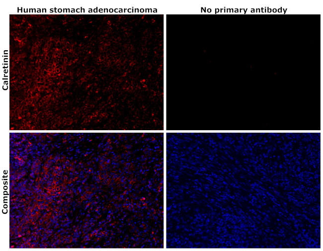 Calretinin Antibody in Immunohistochemistry (Paraffin) (IHC (P))