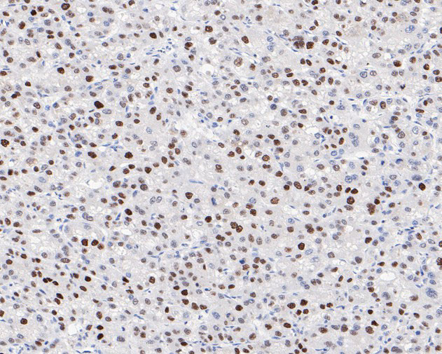 FEN1 Antibody in Immunohistochemistry (Paraffin) (IHC (P))