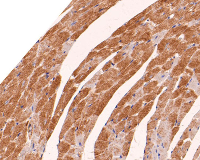 Actin Antibody in Immunohistochemistry (Paraffin) (IHC (P))