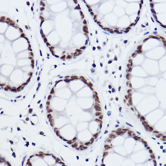 MED4 Antibody in Immunohistochemistry (Paraffin) (IHC (P))