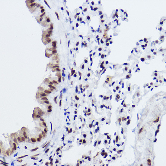 MED4 Antibody in Immunohistochemistry (Paraffin) (IHC (P))