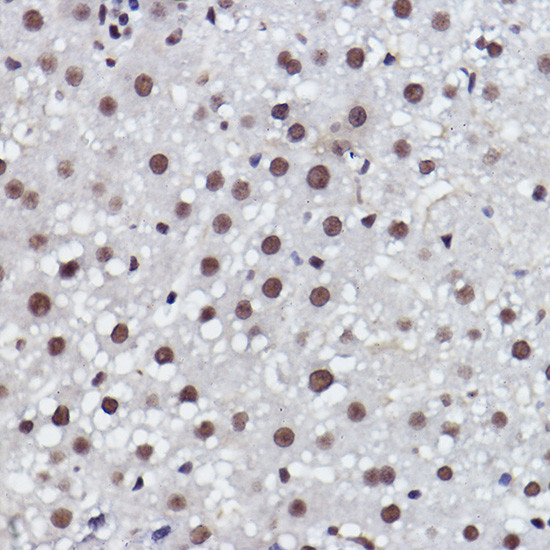 MED4 Antibody in Immunohistochemistry (Paraffin) (IHC (P))